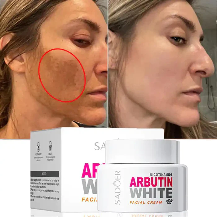 SADOER Nicotinamide Arbutin White Facial Cream 50g - Image 2